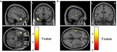 Frontiers | Cross-Sectional and Longitudinal Relationships between ...