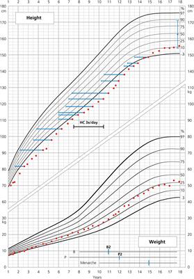 Frontiers | Two Siblings with the Same Severe Form of 21-Hydroxylase ...