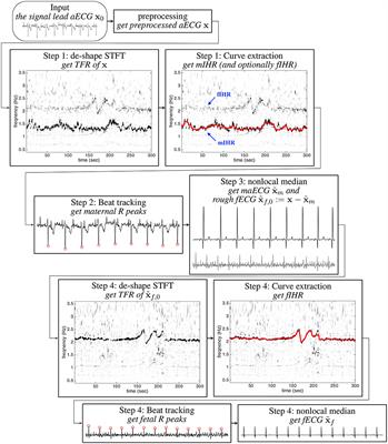 Frontiers Extract Fetal Ecg From Single Lead Abdominal Ecg By De Shape Short Time Fourier Transform And Nonlocal Median Applied Mathematics And Statistics