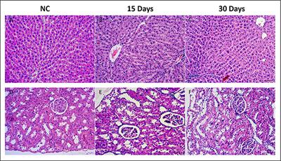 Frontiers 1h Nmr Based Metabolomics Study Of The Toxicological Effects In Rats Induced By Renqing Mangjue Pill A Traditional Tibetan Medicine Pharmacology