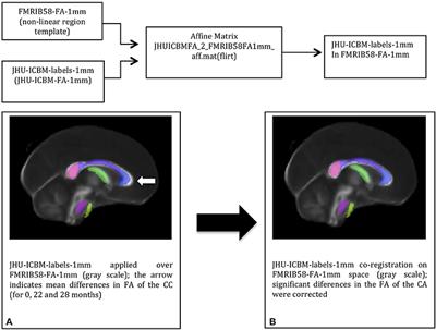 Frontiers Brain Maturation Cognition And Voice Pattern In A Gender Dysphoria Case Under Pubertal Suppression Human Neuroscience