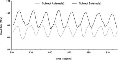 Frontiers New Frontiers In Heart Rate Variability And - 