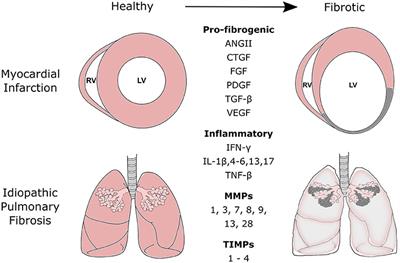 Frontiers | The Processes and Mechanisms of Cardiac and Pulmonary Fibrosis