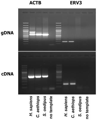 Frontiers | Endogenous Retrovirus 3 – History, Physiology, and Pathology