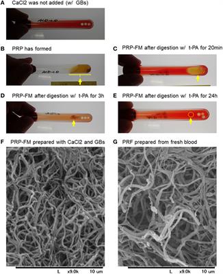 Frontiers Platelet Counts In Insoluble Platelet Rich Fibrin Clots A Direct Method For Accurate Determination Bioengineering And Biotechnology