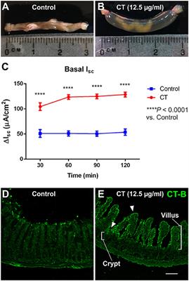 Frontiers Cholinergic Submucosal Neurons Display Increased Excitability Following In Vivo Cholera Toxin Exposure In Mouse Ileum Physiology