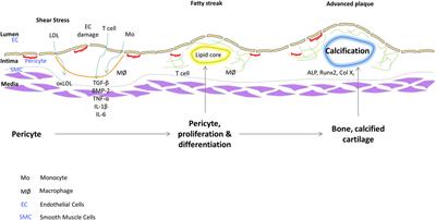 Frontiers | Vascular Calcification: Is it rather a Stem/Progenitor ...