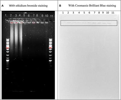 Frontiers Endonuclease From Gram Negative Bacteria Serratia Marcescens Is As Effective As Pulmozyme In The Hydrolysis Of Dna In Sputum Pharmacology