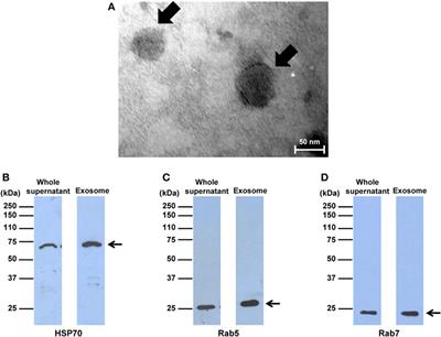 Frontiers - Roles of Macrophage Exosomes in Immune Response to Calcium Oxalate Monohydrate Crystals