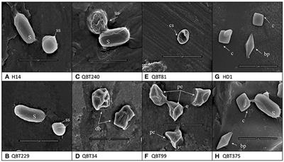 Isolation of Bacillus thuringiensis (Bt) from Soil sample