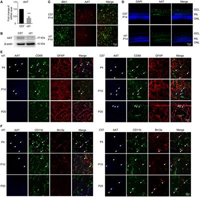 Frontiers | Alpha-1 Antitrypsin Attenuates M1 Microglia-Mediated ...