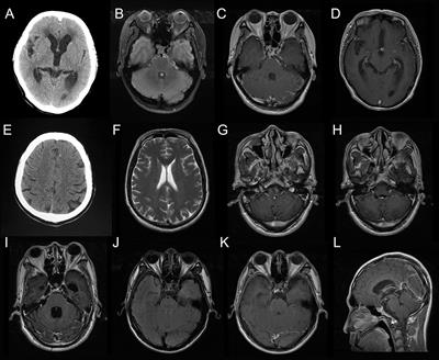 neurocysticercosis