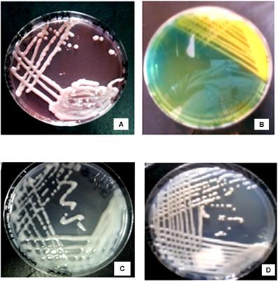 Frontiers | Genetic Characterization and Diversity of Rhizobium ...