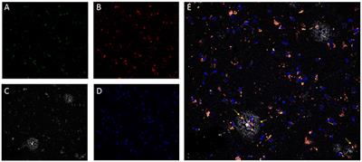 Frontiers | An Overview of the Role of Lipofuscin in Age-Related ...