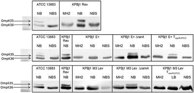 Frontiers Interplay Between Membrane Permeability And Enzymatic Barrier Leads To Antibiotic Dependent Resistance In Klebsiella Pneumoniae Microbiology