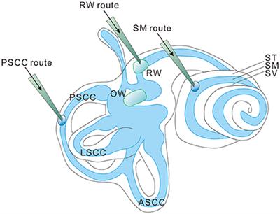 Frontiers Cochlear Gene Therapy For Sensorineural Hearing - 