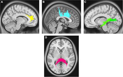 Frontiers Microstructural Changes In Patients With Parkinson S