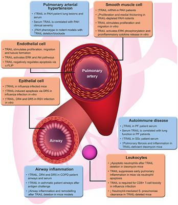 Frontiers | Divergent Roles for TRAIL in Lung Diseases