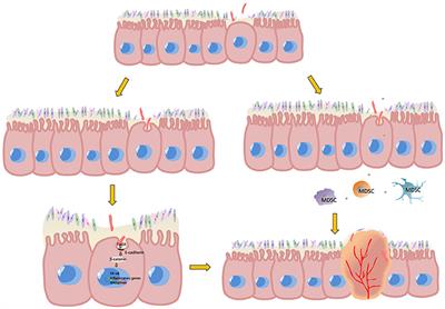 Frontiers | Fusobacterium and Colorectal Cancer