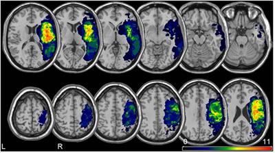 Frontiers | Eye-Tracking Provides a Sensitive Measure of Exploration ...