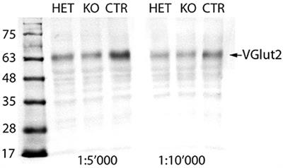 Frontiers Eliminating The Vglut2 Dependent Glutamatergic