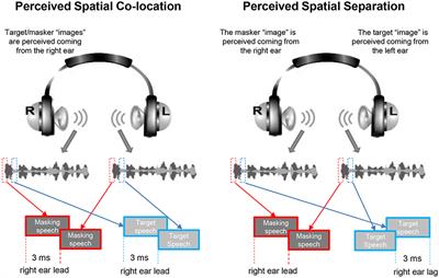 Frontiers Cortical Gray Matter Loss Augmented Vulnerability To Speech On Speech Masking And Delusion In People With Schizophrenia Psychiatry