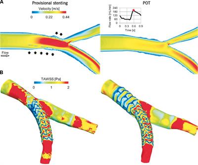 Frontiers | Predictive Physiological Modeling of Percutaneous Coronary ...