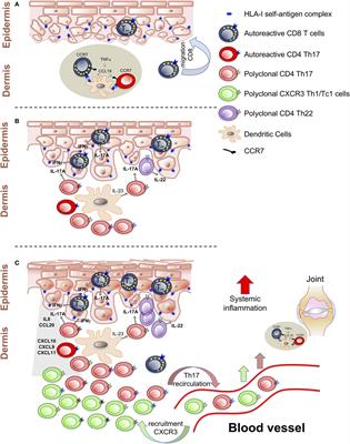 Frontiers | T Cell Hierarchy in the Pathogenesis of Psoriasis and ...