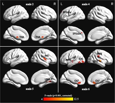 Frontiers A Meta Analysis Of Cognitive Impairment And Decline