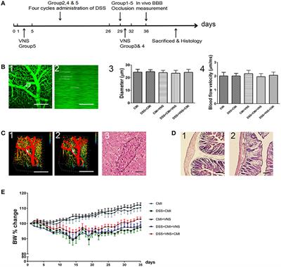 Vagus nerve stimulation as a promising neuroprotection for ischemic stroke  via α7nAchR-dependent inactivation of microglial NLRP3 inflammasome