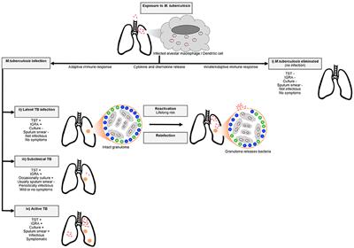 Frontiers Genetic Resistance To Mycobacterium Tuberculosis Infection And Disease Immunology