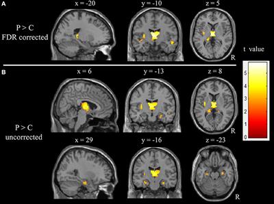 Frontiers | Multimodal Data and Machine Learning for Detecting Specific ...