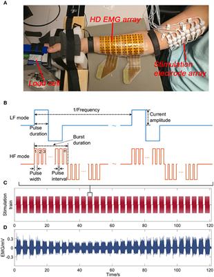 ACSM Journals - Neuromuscular electrical stimulation (NMES) applied to  skeletal muscles is an effective rehabilitation and exercise training  modality. However, the relatively low muscle force and rapid muscle fatigue  induced by NMES