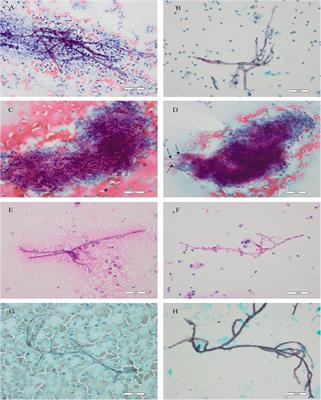 Frontiers | Liquid-Based Cytopathology Test: A Novel Method for ...