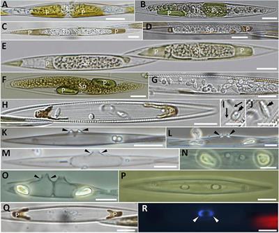 Colonia antiparasitos zz locion botella