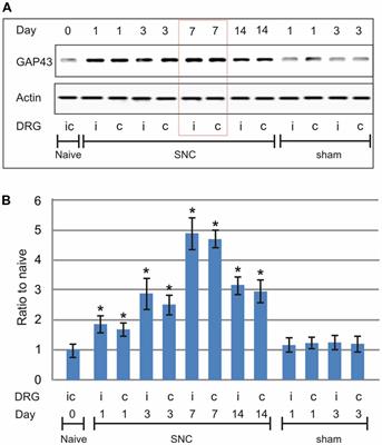 Frontiers | A Conditioning Sciatic Nerve Lesion Triggers a Pro ...