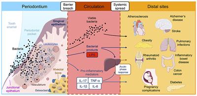 Frontiers | Distal Consequences of Oral Inflammation