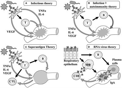 Frontiers | Causes of Kawasaki Disease—From Past to Present