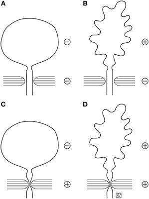 Results of Conservative and Surgical Management of the Neurogenic Bladder  in 160 Children