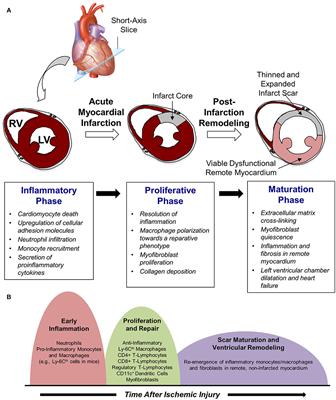 Frontiers | Selectins and Immune Cells in Acute Myocardial Infarction ...