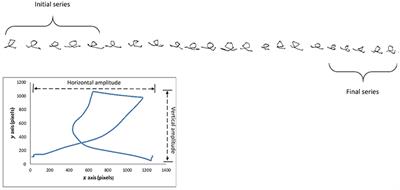 Frontiers | A Kinematic Study of Progressive Micrographia in Parkinson ...