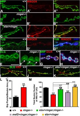 Frontiers Tubulin Polymerization Promoting Protein Ringmaker And Map1b Homolog Futsch Coordinate Microtubule Organization And Synaptic Growth Cellular Neuroscience