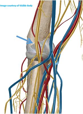 Frontiers | Ultrasound-Guided Biopsies: Medium and Large Joints