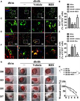 Frontiers Resveratrol Promotes Diabetic Wound Healing Via Sirt1 Foxo1 C Myc Signaling Pathway Mediated Angiogenesis Pharmacology