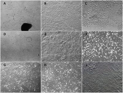 Frontiers Establishment And Characterization Of An Immortalized Porcine Oral Mucosal Epithelial Cell Line As A Cytopathogenic Model For Porcine Circovirus 2 Infection Cellular And Infection Microbiology