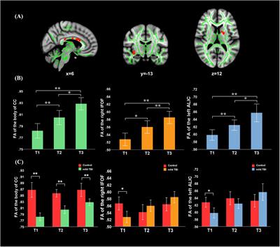 Diffusion Tensor Imaging in Traumatic Brain Injury, Neuropsychology