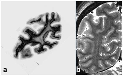 Frontiers | Myelin and Modeling: Bootstrapping Cortical Microcircuits ...