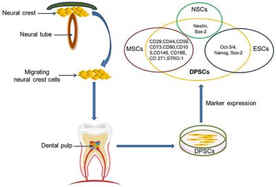 Frontiers Dental Pulp Stem Cells An Attractive Alternative For Cell Therapy In Ischemic Stroke Neurology