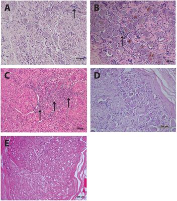 Frontiers | Persistence of a T Cell Infiltrate in Human Ganglia Years ...