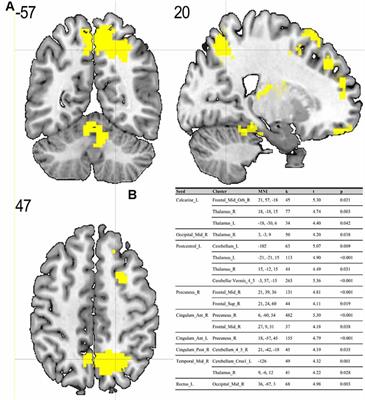 Frontiers  Diurnal Variations in Neural Activity of Healthy Human